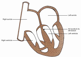 1204_Interventricular Septum.png